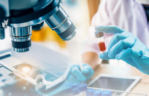 Detectan nueva variante del VIH más agresiva y contagiosa