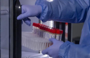 OMS confirma más de cinco mil casos en el mundo de Viruela del mono